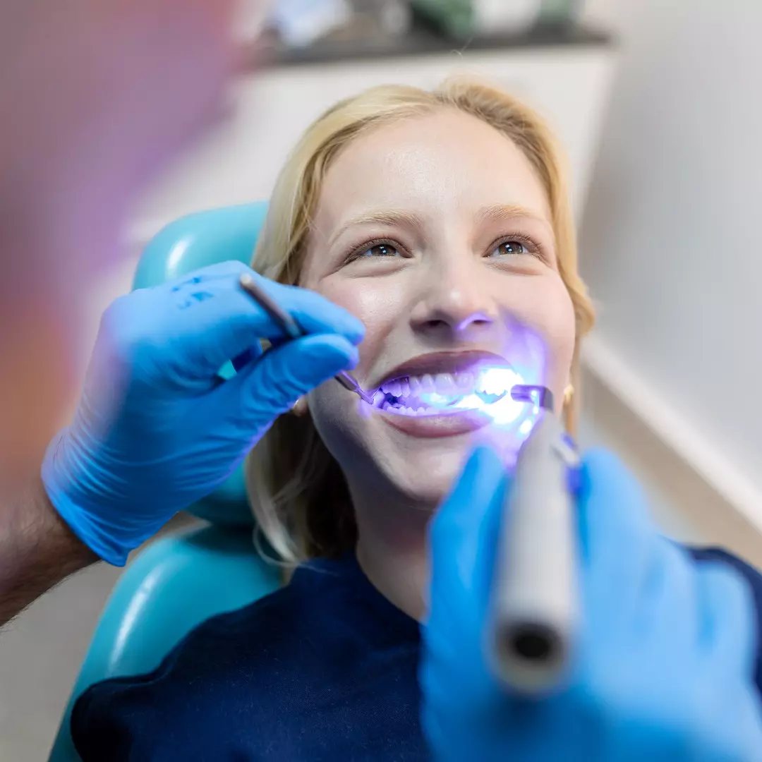 blanqueamiento dental