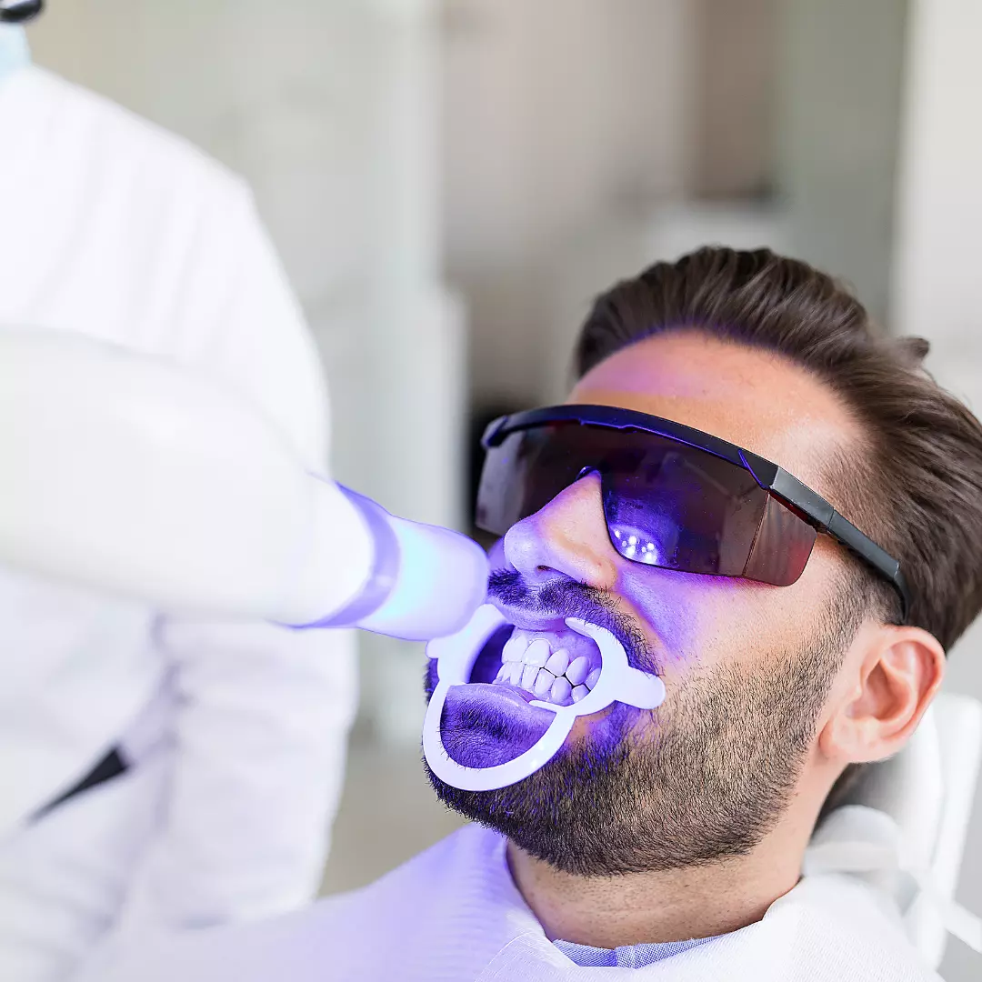 blanqueamiento dental